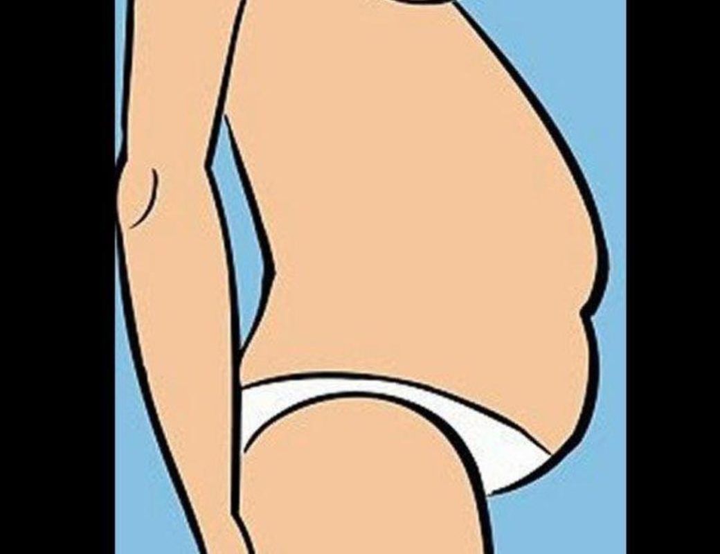 Cortisol belly